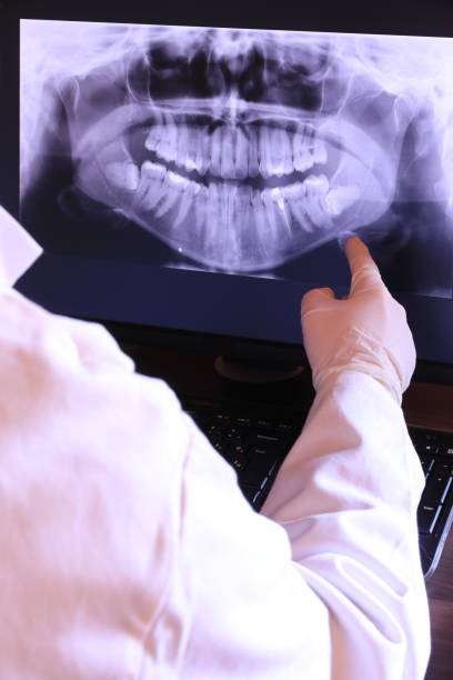 Best Dentist for Tooth Abscess  in Huron, OH