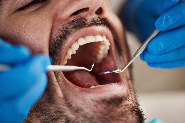 Best Knocked-Out Tooth Emergency  in Huron, OH